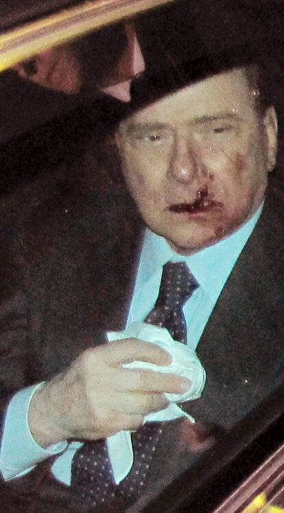 Berlusconi, de camino al hospital tras la agresión.