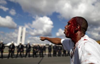 Manifestante ensanguentado na Esplanada dos Ministérios. 