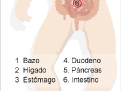 Órganos trasplantados