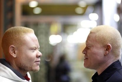Los hermanos albinos Charles F. Kamdem (izquierda) y Calvin W. Kamdem.