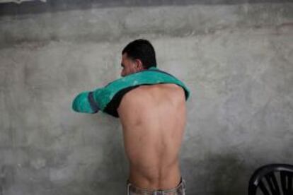Un inmigrante muestra las marcas causadas por la paliza del ejército israelí.