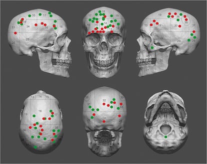 Recreación en 3D de las heridas en la cabeza de los restos humanos. En verde, los traumas en el cráneo que cicatrizaron. En rojo los sin cicatrizar, es decir, los que les mataron.