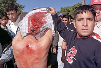 Un hombre muestra las heridas sufridas por otro en las protestas.