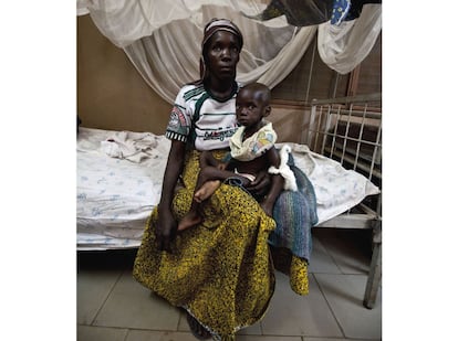 En Malí cada día mueren 50 niños por enfermedades aparejadas al hambre. En la imagen, una madre sostiene a su hijo en un centro de recuperación de un centro nutricional de Virimadjo (Bamako).