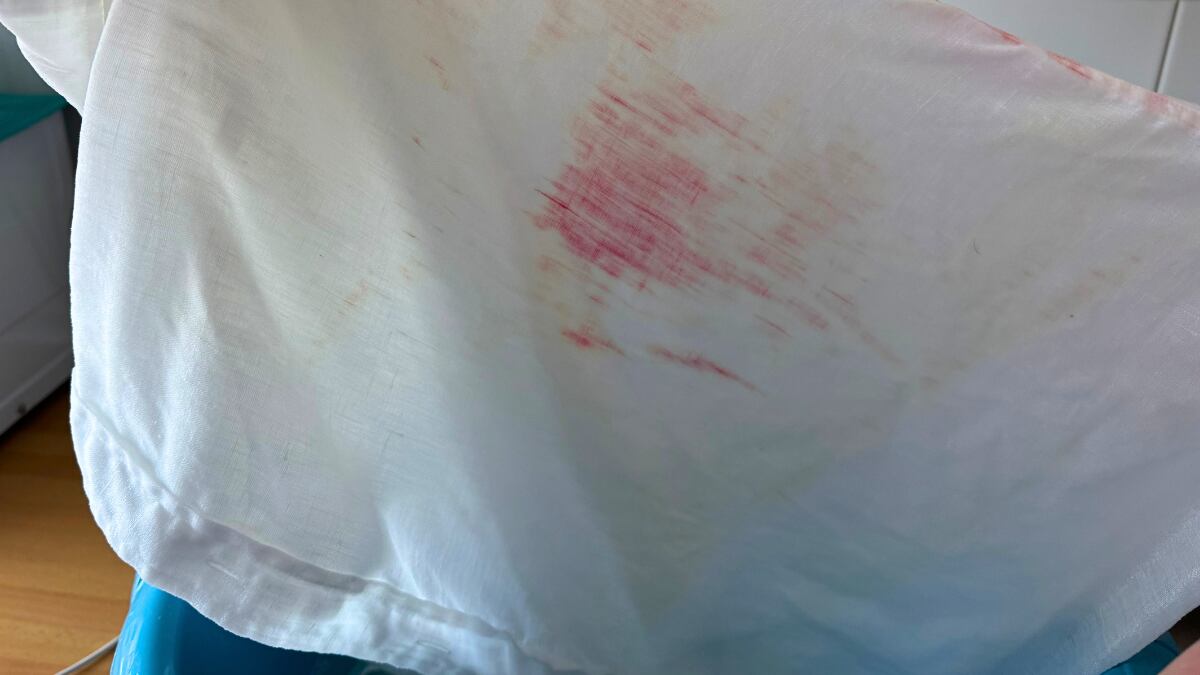 No utilices lejía para quitar manchas de crema solar en tu ropa blanca.