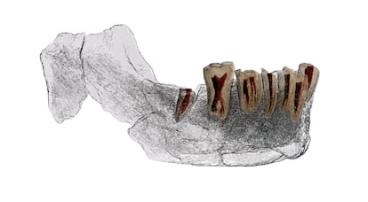 Imagem radiográfica da mandíbula do ‘Homo’ de Nesher Ramla descoberta em Israel.