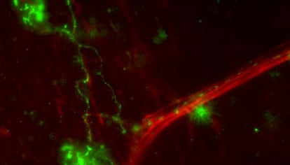 Nervios de la superficie ocular (en verde,los que contienen la prote&iacute;naTRPM8)