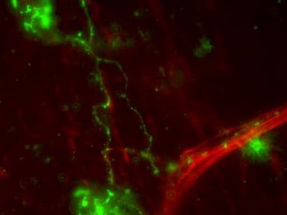 Nervios de la superficie ocular (en verde,los que contienen la proteínaTRPM8)