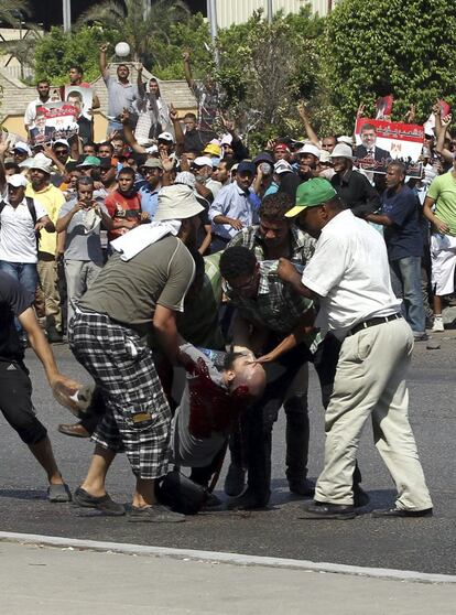  Simpatizantes del presidente depuesto Mohamed Morsi trasladan a un herido que fue disparado por el Ejército egipcio durante una manifestación frente a la sede de la Guardia Republicana en El Cairo, Egipto, el 5 de julio del 2013. 