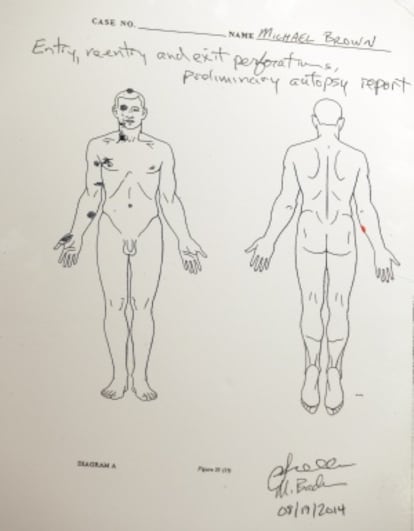 Un diagrama, con resultados preliminares de la segunda autopsia, que muestra los impactos de bala en el cuerpo de Brown