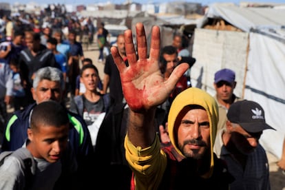 Un palestino muestra manchas de sangre en la palma de la mano, tras recoger suministros de ayuda en Jan Yunis.