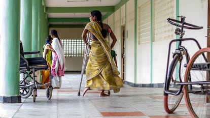 Uma menina que sofre de paralisia em consequência da pólio