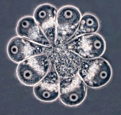 Grupo de 10 amebas poco conocidas, caracterizadas por investigadores del Censo de la Vida Marina.