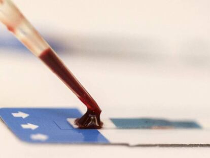 Una enfermera analiza una muestra de sangre durante una prueba gratuita de VIH en Bangkok (Tailandia), en 2014. 