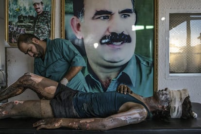 O fotógrafo brasileiro Mauricio Lima foi o vencedor na categoria Notícias – Imagem Única com esta foto feita para o The New York Times. A imagem mostra um médico aplicando pomada em um jovem de 16 anos, membro do grupo terrorista Estado Islâmico, diante de um pôster com o rosto de Abdullah Öcalan, presidente do Partido dos Trabalhadores do Curdistão, em um hospital nos arredores de Hasaka (Síria), em 1o de agosto de 2015.