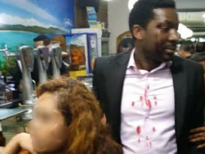 El intérprete africano Marius Makon fue golpeado el sábado con una botella en una cervecería por una mujer que lo llamó  negro de mierda 