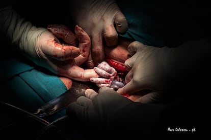 La foto ganadora, titulada ‘Cogiéndonos las manos’ ha sido realizada por Nora Dalmasso (Argentina). Dalmasso la describe de la siguiente forma: "Parto por cesárea, en el cual se trató de sacar al bebé en su propia bolsa. En el momento que se rompe saca su manita y sujeta un dedo al médico".