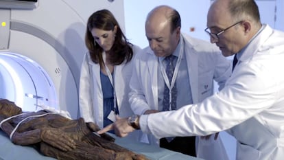 One of the mummies is examined at the Hospital QuirónSalud Madrid.