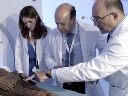 One of the mummies is examined at the Hospital QuirónSalud Madrid.