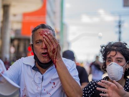 Daniel Campelo da Silva, 51 anos, que ficou cego de um olho a após ser atingido por uma bala de borracha da polícia, que dispersou violentamente o protesto neste sábado.