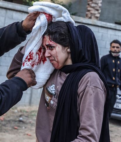 Una mujer palestina herida recibe ayuda, tras un ataque israelí en Deir al Balah, en el centro de la Franja, este viernes.