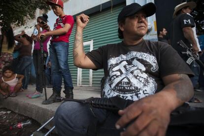 Ruperto Anaya, miembro de la Fuerza Rural, muestra una cicatriz del enfrentamiento del día anterior.