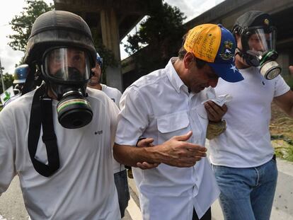 Henrique Capriles é atendido depois da agressão