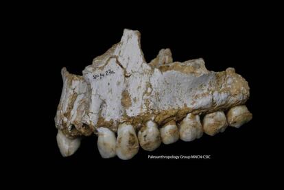 The jaw of the Neanderthal from the El Sidrón cave with poplar bark traces.