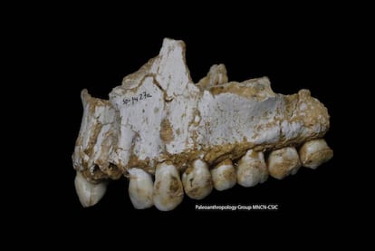 The jaw of the Neanderthal from the El Sidrón cave with poplar bark traces.