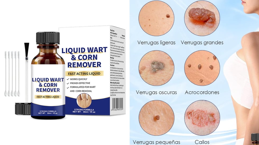 Kit antiverrugas fácil de aplicar.