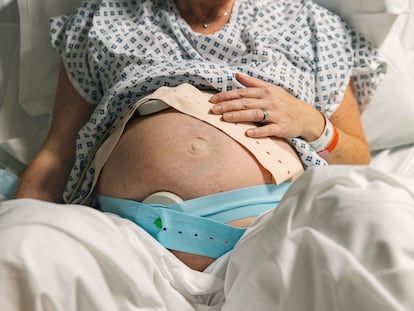 Una mujer embarazada, con las cinchas de monitorización del estado fetal poco antes del parto.