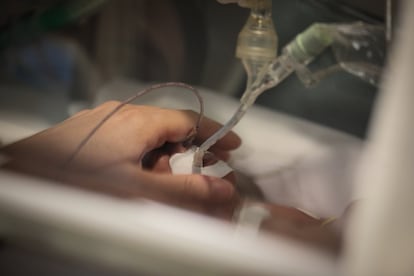 La pequeña Zeo en una de las incubadoras del Hospital Gregorio Marañón.