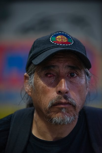 Un hombre que sufrió trauma ocular asiste a la conmemoración del aniversario del estallido social.