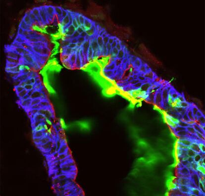 Imagen del tejido intestinal fabricado en un laboratorio a partir de células madre embrionarias e inducidas.
