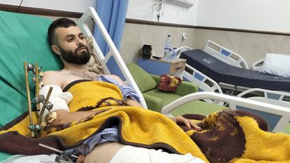 Myahed Abadi, en el hospital de la ciudad cisjordana de Yenín en el que se recupera de las heridas, este lunes.