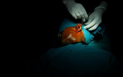 Un médico realiza la cirugía del oído medio dentro de un quirófano del Lifeline Express.
