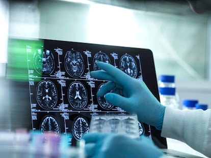 Cómo la tecnología pretende mejorar los diagnósticos psiquiátricos