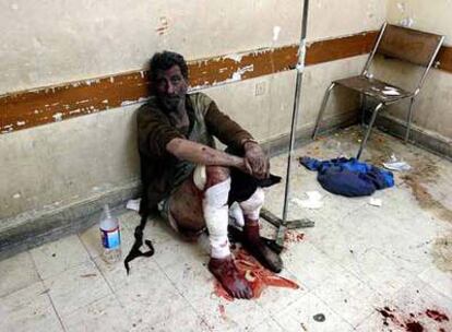 Un herido en el atentado espera ser atendido en un hospital en Bagdad.