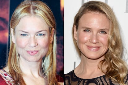 Renée Zellweger.