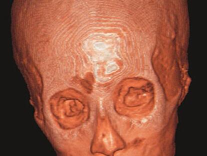 El rostro de la momia de Tutankamón.