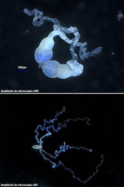 The blue colour of these wasp reproductive organs comes from a large number of viral particles. Microplitis demolitor wasps produce domesticated viral particles in their ovaries (top image). Diachasmimorpha longicaudata wasps may be in the early stages of domesticating a poxvirus that replicates in their venom glands (bottom image).