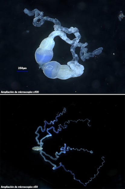 El color azul de estos órganos reproductores de avispa procede de un gran número de partículas víricas.
Las avispas 'Microplitis demolitor' producen partículas víricas domesticadas en sus ovarios (imagen superior). Las avispas 'Diachasmimorpha longicaudata' podrían estar en las primeras fases de domesticación de un poxvirus que se replica en sus glándulas venenosas (imagen inferior).