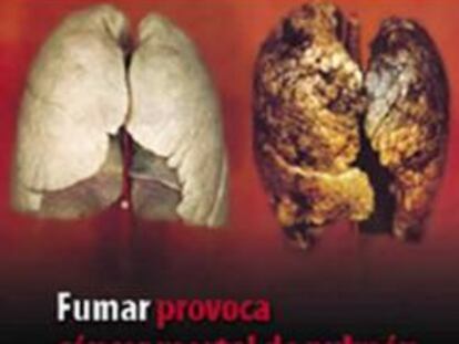 Una de las imágenes que incluirán las cajetillas de tabaco