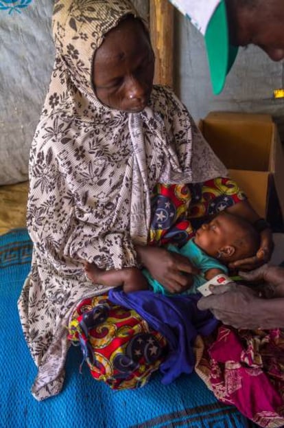 Los médicos miden la circunferencia del brazo de un niño en la unidad móvil del campo de refugiados de Magui (Chad).