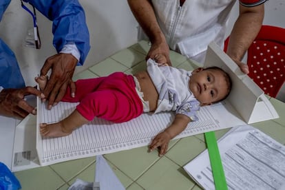 Uno de los niños atendidos en el centro médico que utiliza Médicos Sin Fronteras en el pueblo colombiano de La Gabarra, Norte de Santander, de lunes a viernes, desde 2018.