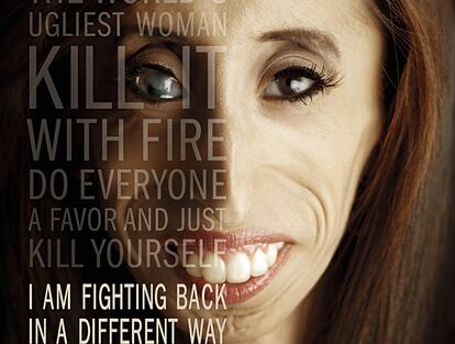 Lizzie Velasquez