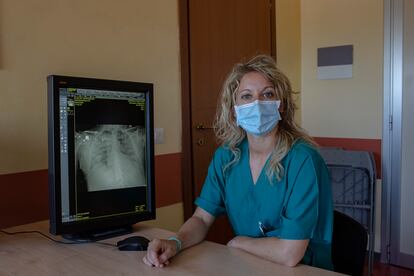 La doctora Annalisa Malara realizó el primer diagnosticó de covid-19 en Italia. En la foto, junto a una radiografía de un enfermo de coronavirus.