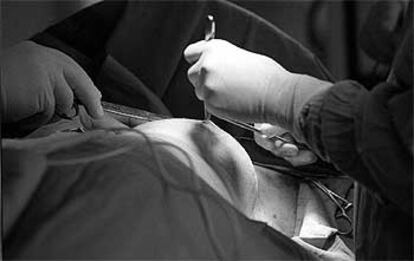 Biopsia de mama en el hospital Vall d'Hebron de Barcelona.