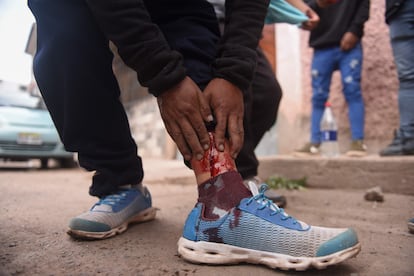 Un manifestante muestra la herida que sufrió en la pierna durante las manifestaciones de este miércoles en Cusco.