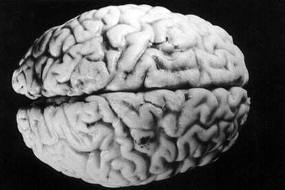 Cerebro humano.